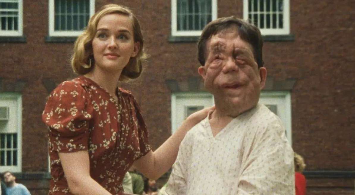 Adam Pearson's Wife Untold Stories and an Inspiring Journey