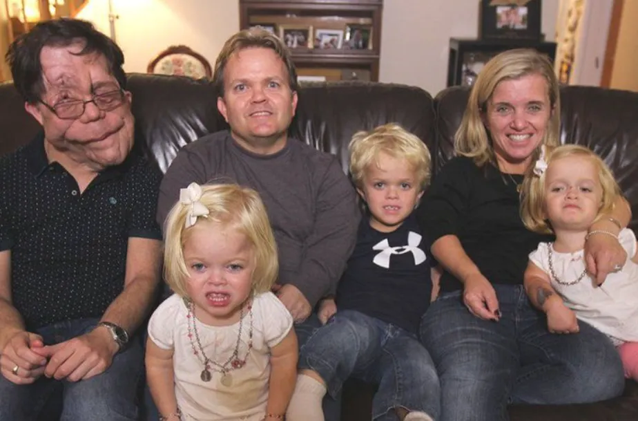 Adam Pearson's Wife Untold Stories and an Inspiring Journey